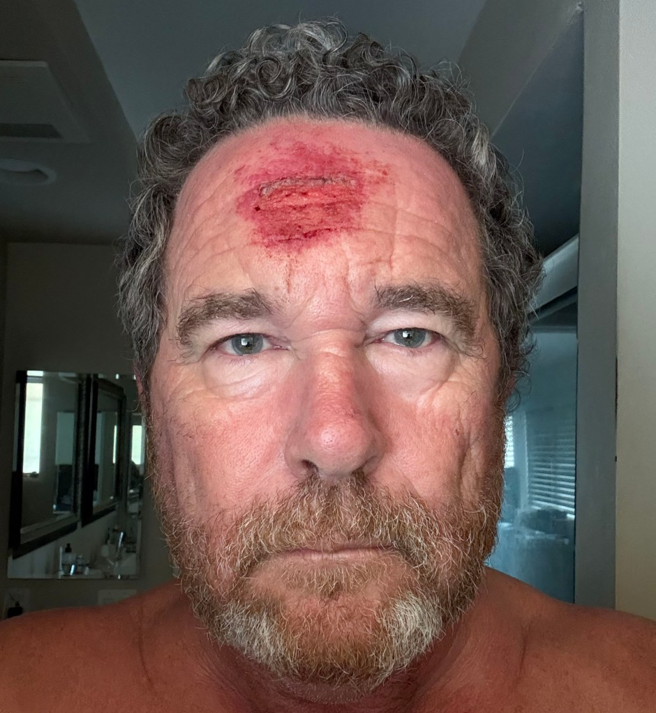 洛杉矶骚乱中，美媒摄影记者被橡皮子弹击中头部，并记录下这“恐怖一刻”